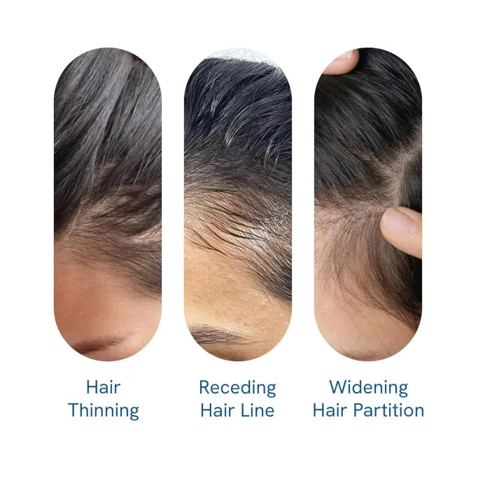 Be Bodywise Advanced Hair Growth Roll-On Serum
