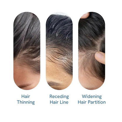 Be Bodywise Advanced Hair Growth Roll-On Serum